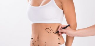 Czym są zabiegi liposukcji? kobieta zabieg liposukcji