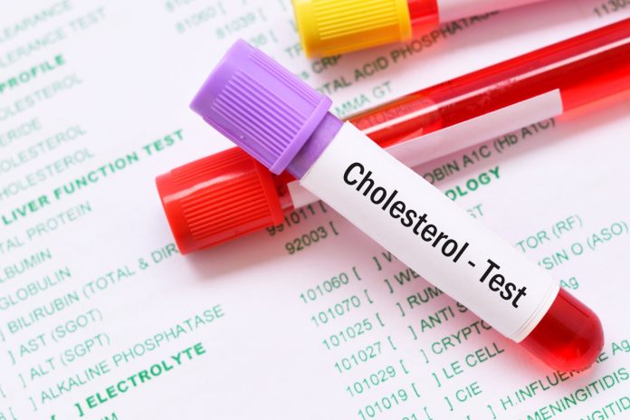 cholesterol testy leczenie cholesterol testy leczenie