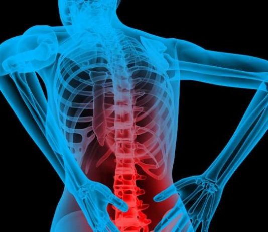 Ból pleców i kręgosłupa – przyczyny, objawy, leki ból pleców