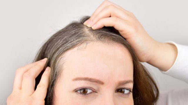 zdrowszy na przeszczepienie włosów