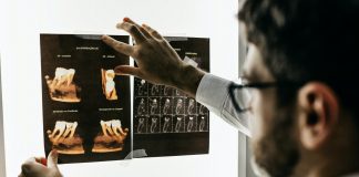 Jak wygląda leczenie kanałowe? prześwietlenie zębów podczas leczenia kanałowego