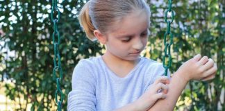 Czym leczyć egzemę u dziecka? egzema, swedzenie. wypryski u dziecka