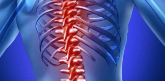 Ból kręgosłupa – jak sobie z nim radzić? bolący kręgosłup a zdrowie co robić