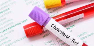 Co na cholesterol bez recepty? Bezpieczne sposoby na obniżenie cholesterolu cholesterol testy leczenie