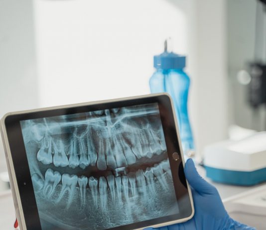 Aparaty ortodontyczne dla osób w każdym wieku ortodonta bada