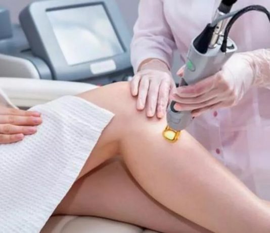 Laserowe zamykanie naczynek – skuteczne zabiegi tylko z profesjonalnym sprzętem laser naczynka