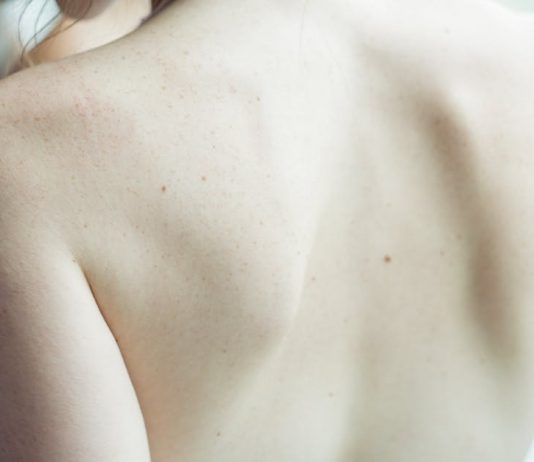 Czym jest chiropraktyka i czy może Tobie pomóc? zdrowa kobieta chiropraktyka