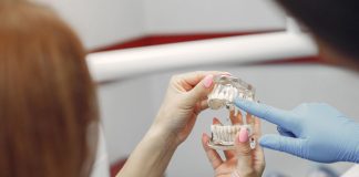 Dla kogo są implanty zębowe? Czy każdy może z nich korzystać? profesjonalne implanty na zęby