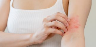 Czerwone plamy na ciele – skąd się biorą? czerwone plamy na ciele