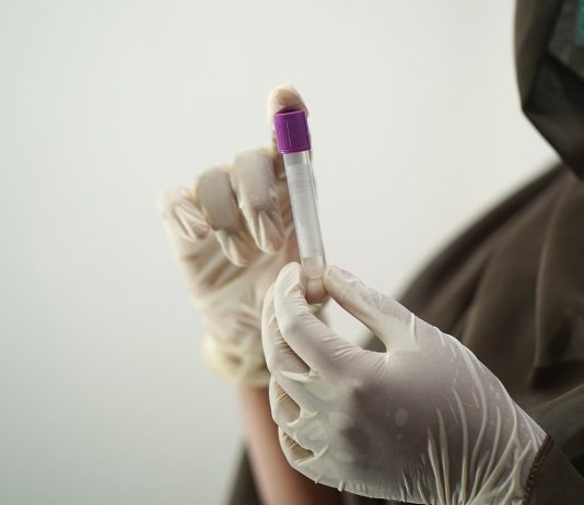 Badanie krwi – zabronione zachowania przed pobraniem próbki do analizy morfologicznej Przed pobraniem krwi nie należy spożywać posiłków ani wykonywać intensywnych ćwiczeń fizycznych