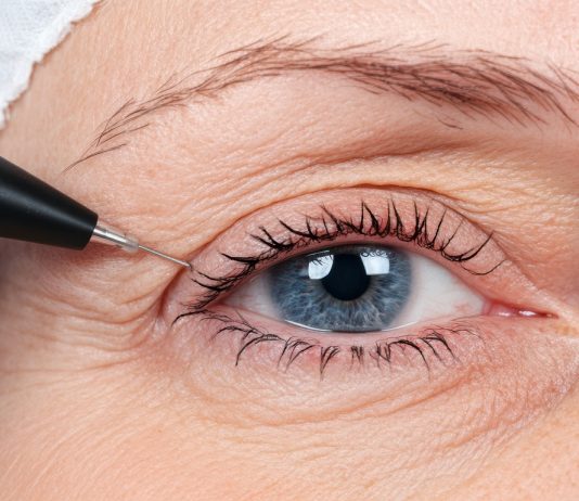 Chirurgiczna plastyka powiek opuchnięte powieki