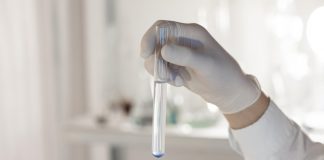 Kreatynina – badanie i wskazania do jego wykonania. Co oznacza podwyższona kreatynina? badanie na kreatynine