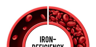 Niedobór żelaza w organizmie: bezpieczna suplementacja bez diagnostyki laboratoryjnej Żelazo bez konsultacji lekarskiej można suplementować tylko w okresie intensywnego krwawienia miesiączkowego