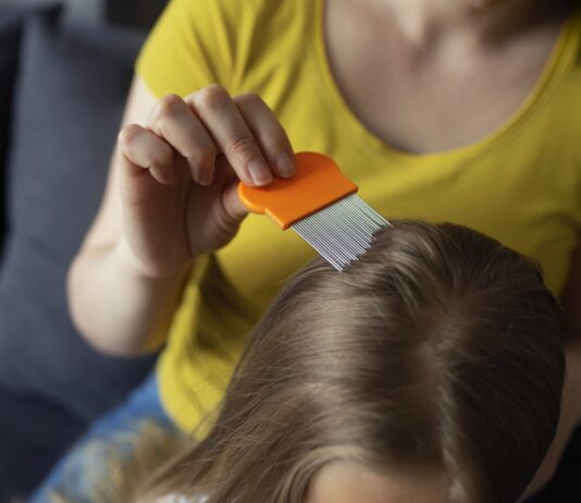 Wszawica u dzieci. Dlaczego najczęściej chorują właśnie najmłodsi? wszawica u dzieci