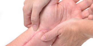 Masaż powięziowy, terapia bliznowa, mobilizacja tkanek – które techniki manualne najszybciej wygładzą bliznę? Fizjoterapeuta masujący widoczną bliznę na skórze ramienia pacjenta rękami