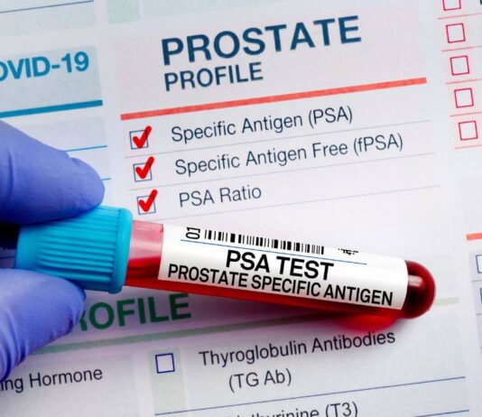 Badanie PSA: czym jest marker prostaty, jakie są normy i kiedy wynik powinien skłonić cię do działania dojrzały mężczyzna konsultujący prostatę z lekarzem w białym kitlu w gabinecie