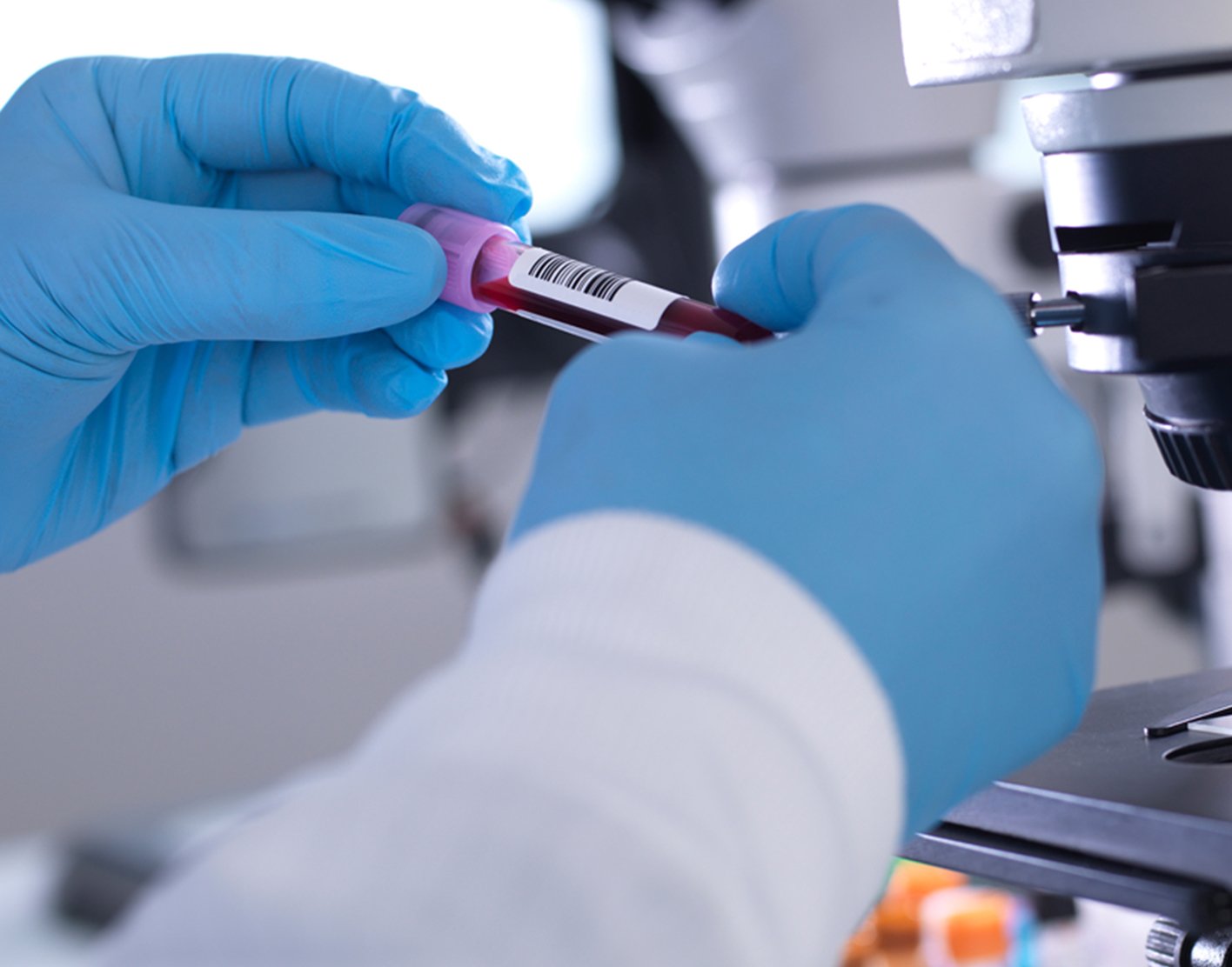 dieta bogata w likopen dla prostaty mężczyzna jedzący pomidory i brokuły na talerzu w kuchni domowej