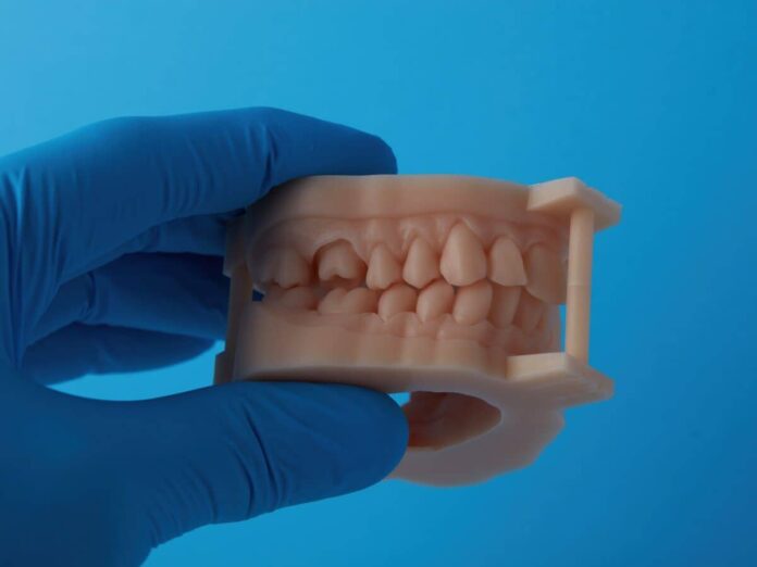 przyszlosc protez dentystycznych technologia 3d przyszlosc protez dentystycznych technologia 3d