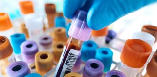 Sztuczna krew: jak syntetyczne substytuty naśladują funkcje prawdziwych krwinek i kiedy zastąpią transfuzje? symulacja kropli na bialej powierzchni