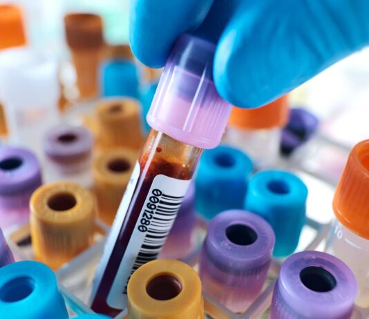 Sztuczna krew: jak syntetyczne substytuty naśladują funkcje prawdziwych krwinek i kiedy zastąpią transfuzje? symulacja kropli na bialej powierzchni