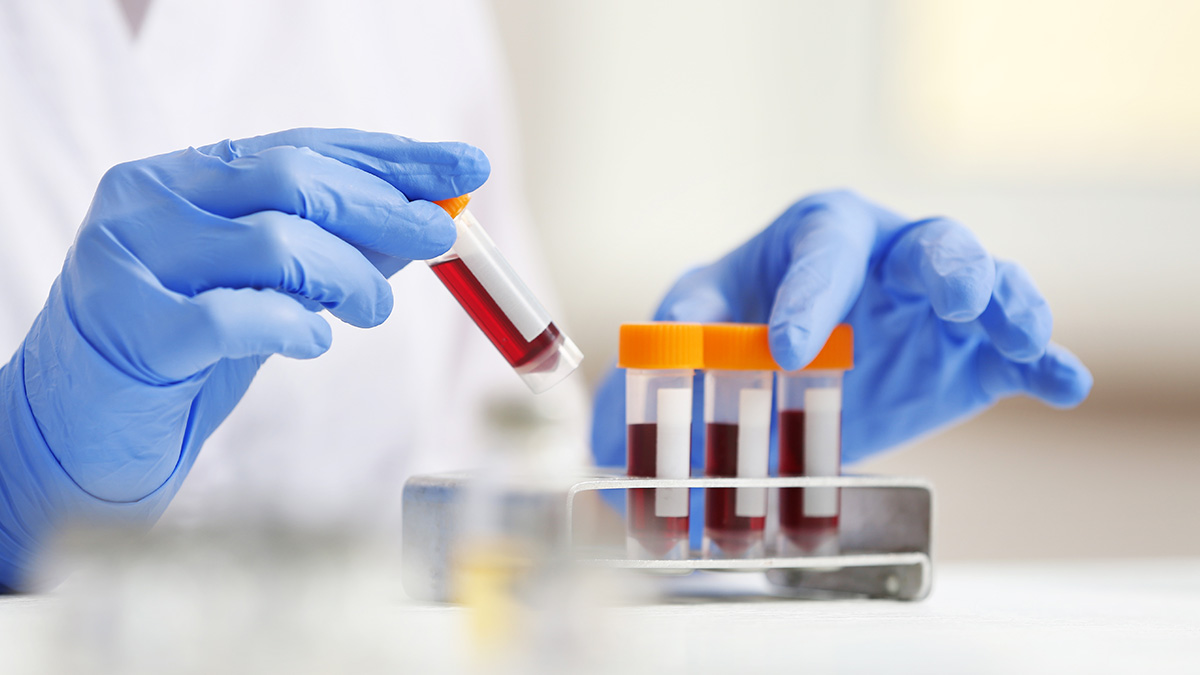 Badacz wstrzykujący sztuczną krew do probówki z tlenem w szklanym naczyniu