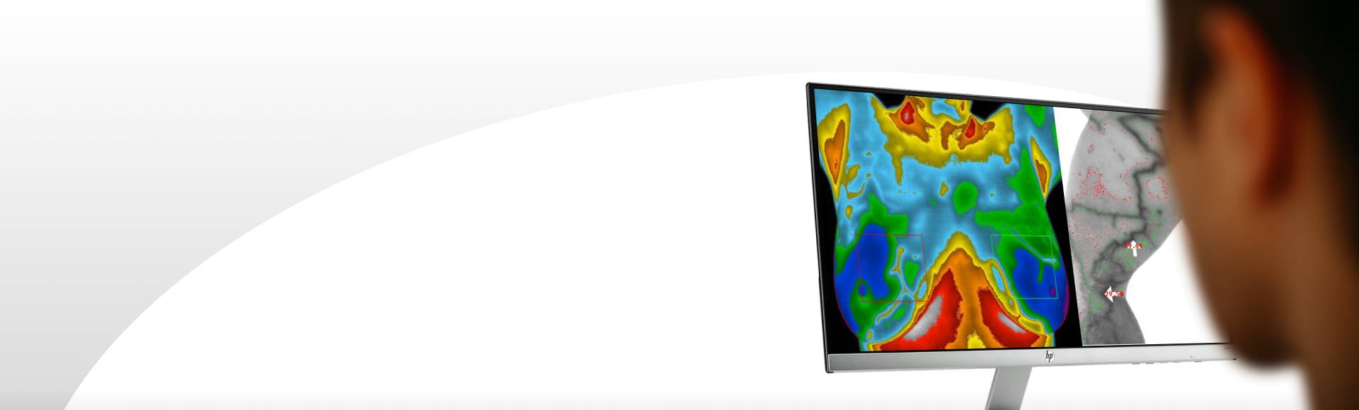 termogram wskazujący zapalenie w klatce piersiowej kolorowy termogram torsu pacjenta z czerwonymi plamami wskazującymi stan zapalny