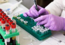 Badanie żelaza: przygotowanie, pobranie i wynik z ferrytyną i transferryną iron panel 7b24 analiza wynikow laboratoryjnych