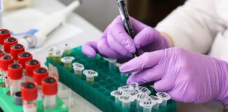 Badanie żelaza: przygotowanie, pobranie i wynik z ferrytyną i transferryną iron panel 7b24 analiza wynikow laboratoryjnych
