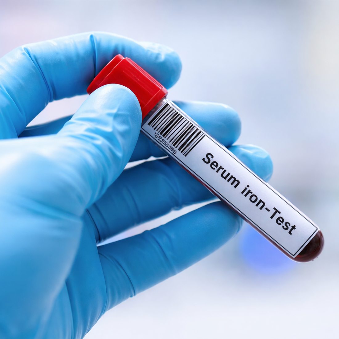Ocena zapasów w materiale biologicznym Laborantka kontroluje próbki krwi przed oznaczeniem stężenia żelaza